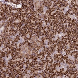 PVRIG Antibody, Novus Biologicals 0.1mL; Unlabeled:Antibodies, Polyclonal